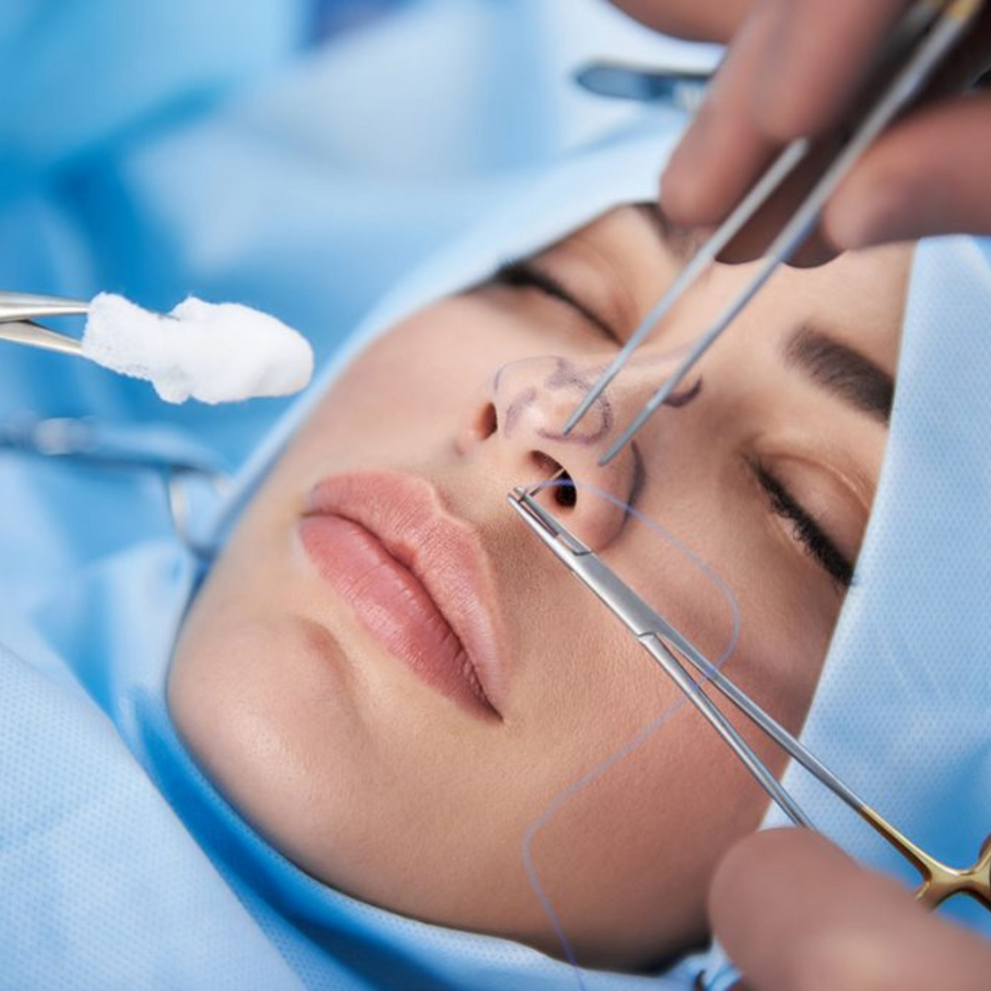 Nose Surgery