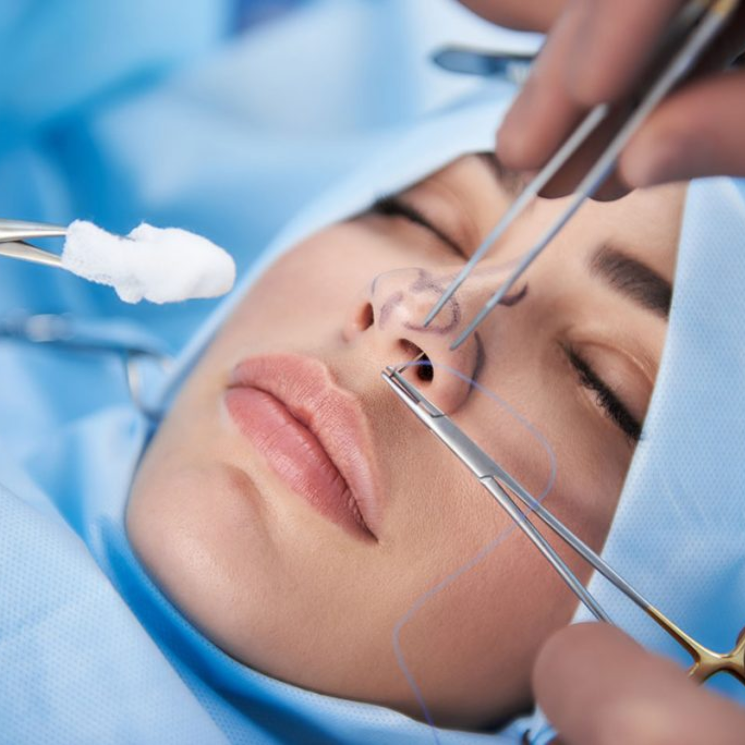 Nose Surgery