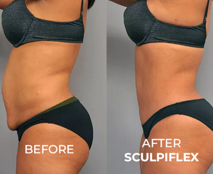 Tone and Firm with Just 15 Minutes a Day from Home. Painless and Clinically Proven.