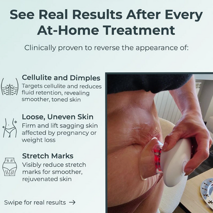 Tone and Firm with Just 15 Minutes a Day from Home. Painless and Clinically Proven.