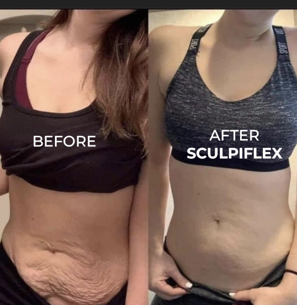 Tone and Firm with Just 15 Minutes a Day from Home. Painless and Clinically Proven.