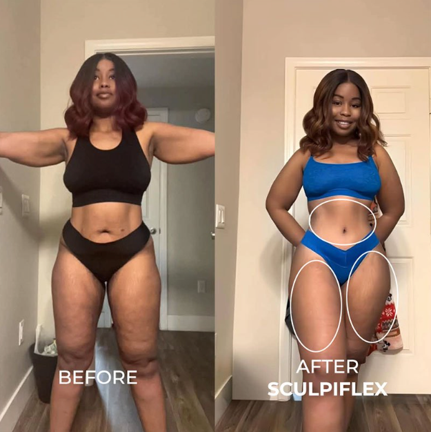 Tone and Firm with Just 15 Minutes a Day from Home. Painless and Clinically Proven.