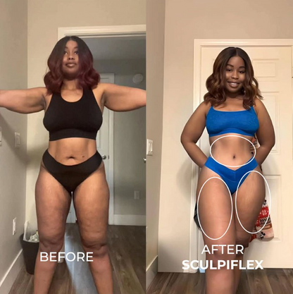 Tone and Firm with Just 15 Minutes a Day from Home. Painless and Clinically Proven.